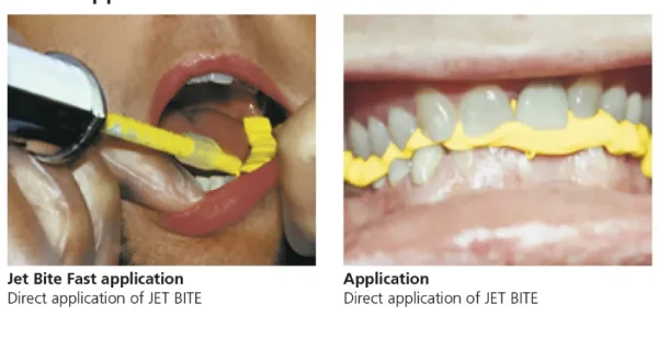 Coltene Jet Bite - Image 4