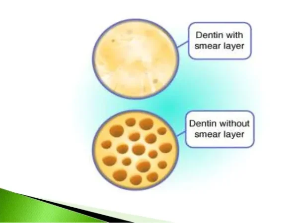 GC Dentin Conditioner - Image 2