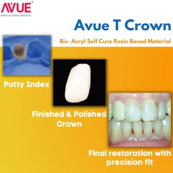 Avue T Crown AM 76gm - Image 6