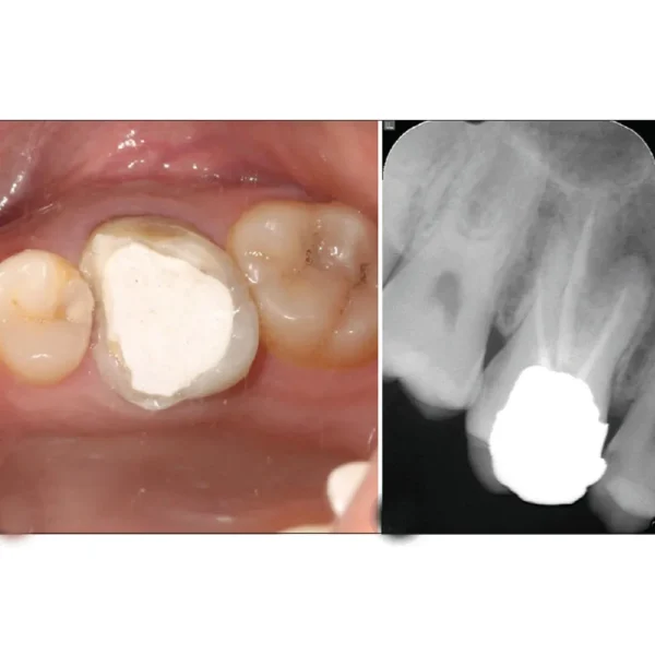 Cavitemp - Image 2
