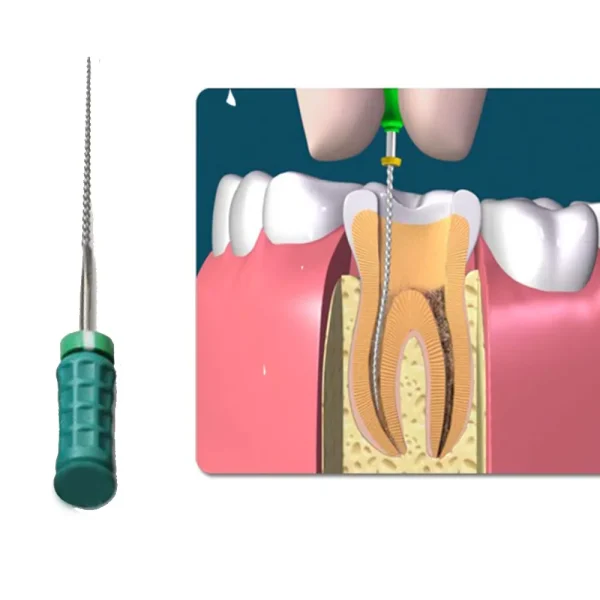 Dentsply M-Access K-Files 25mm (Hand Operated Files) - Image 8