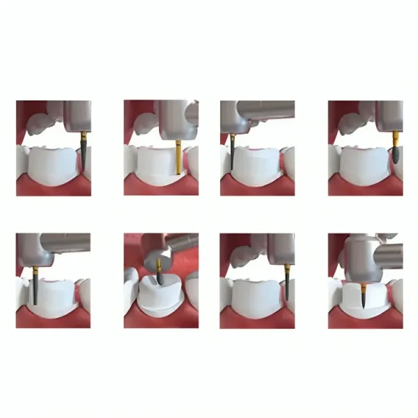 Coltene Crown Preparation Kit IN60013857 - Image 2