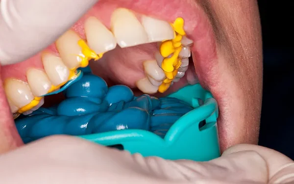 Accusil Combo+Light Body - Image 3