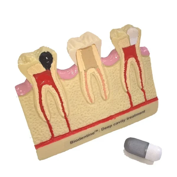 Septodont Biodentine Kit ( Pack of 5 capsules ) - Image 9