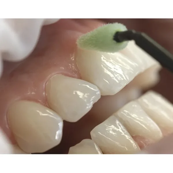 Ivoclar Fluor Protector S - Image 3