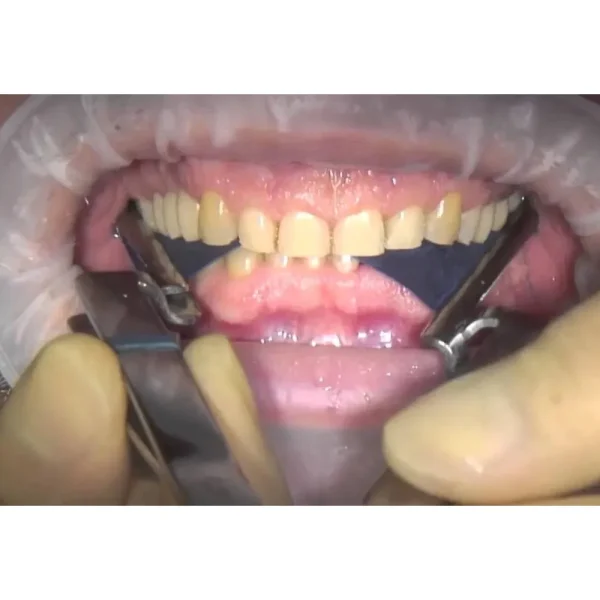Articulating Paper MDM - Image 3