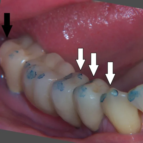 Articulating Paper MDM - Image 2