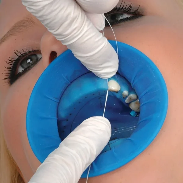 Ivoclar Optradam Plus - Image 4