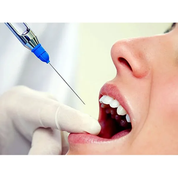 Septodont Aspirating Syringe - Image 3