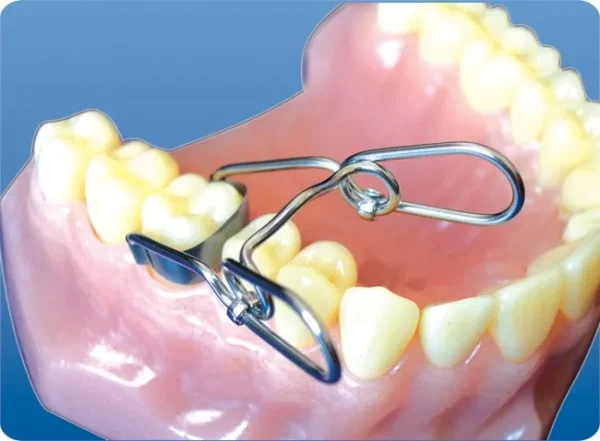 Saddle Matrix Kit - Image 5