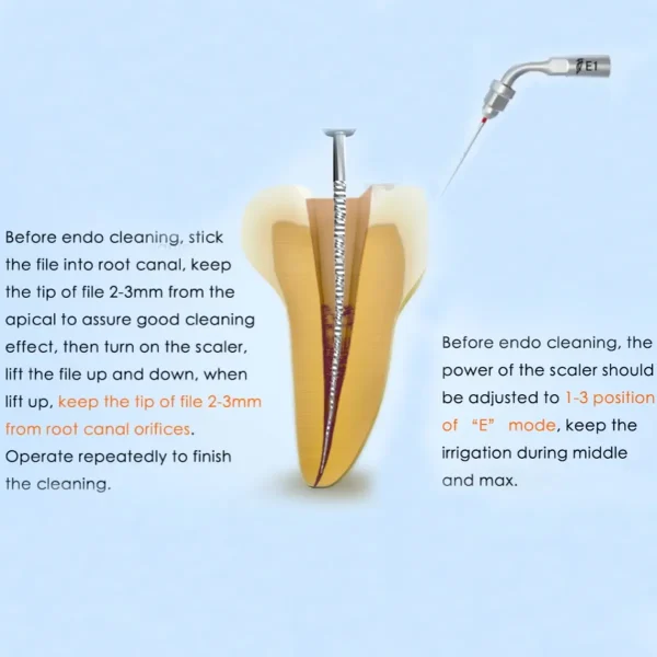 Scaling Tip E-1 Woodpecker - Image 2