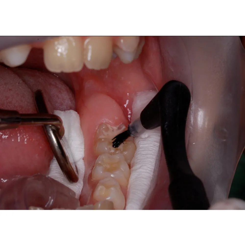 Oro Cotton Roll - Image 4