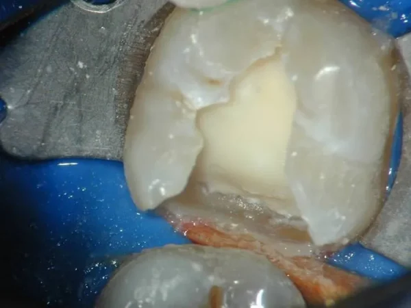 Hydrocal LC 5gm - Image 2