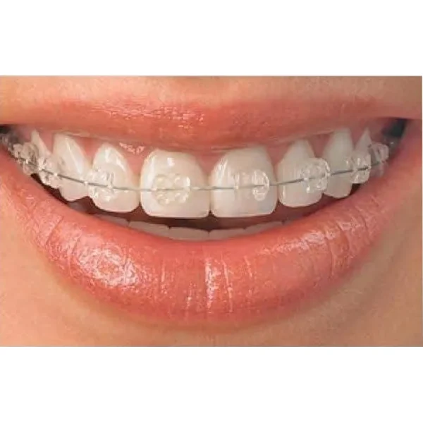Ortho Brackets Koden Basic - Image 3