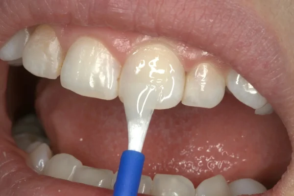 Prvest Fluorodip Bioactive - Image 2
