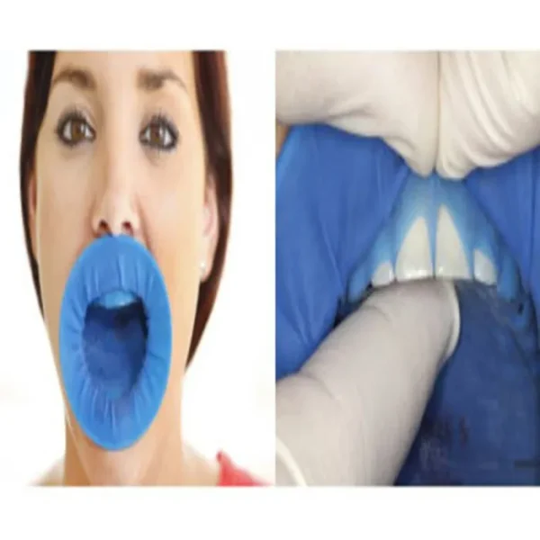 Optra Dam Plus Assortment - Image 3