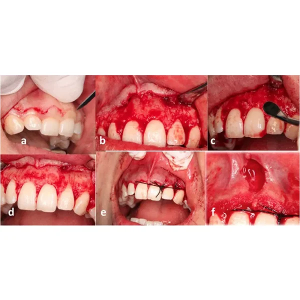 GDC Oral Surgical Set(Set Of 10) - Image 3