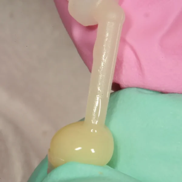 Oro Intraoral Core Buildup - Image 2