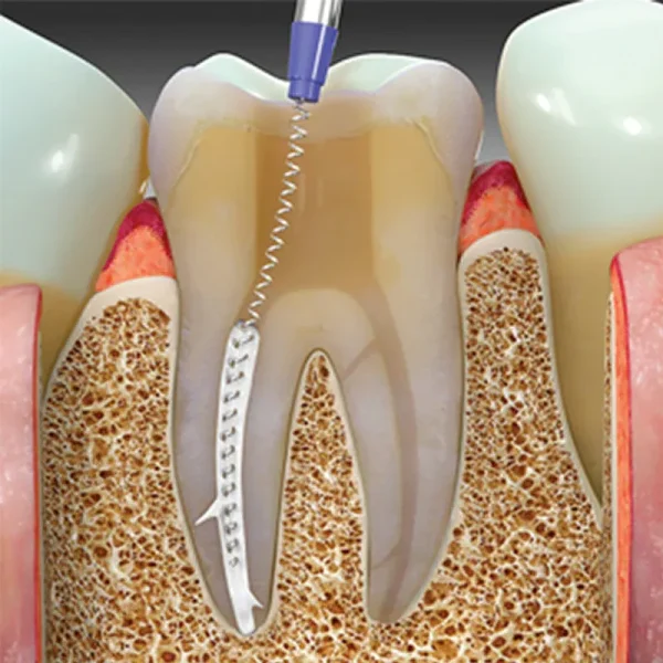 Paste Carrier Mani - Image 2
