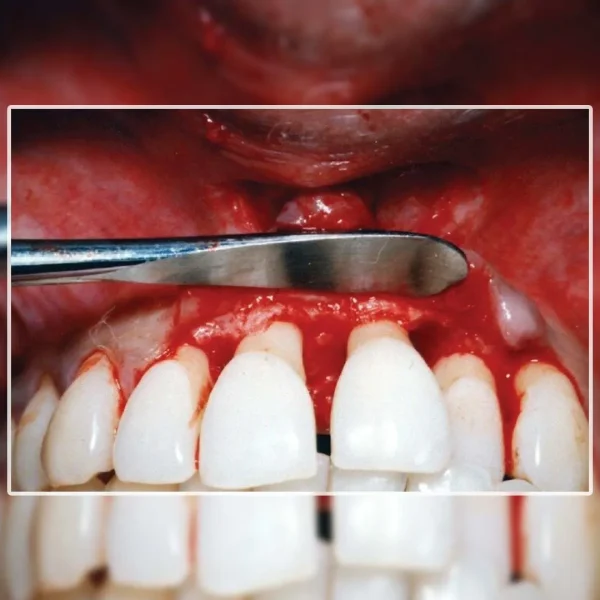 GDC Oral Surgical Set(Set Of 10) - Image 2