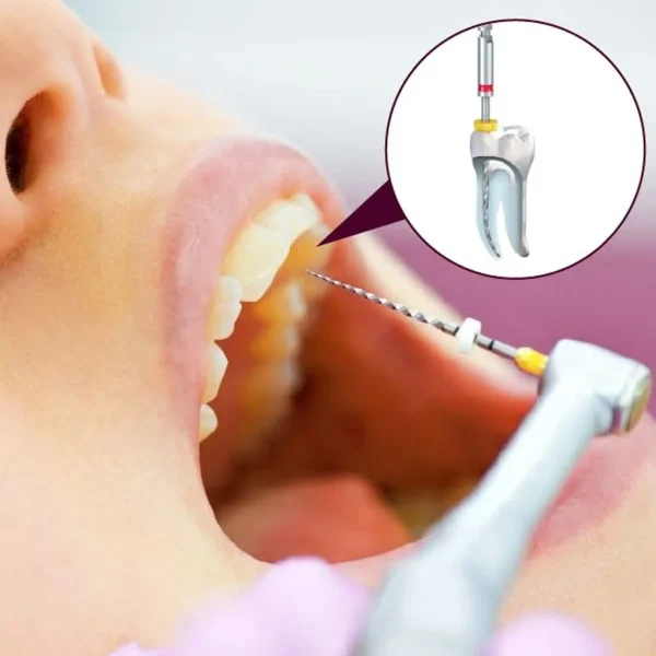 PROTAPER GOLD F1 - Image 2