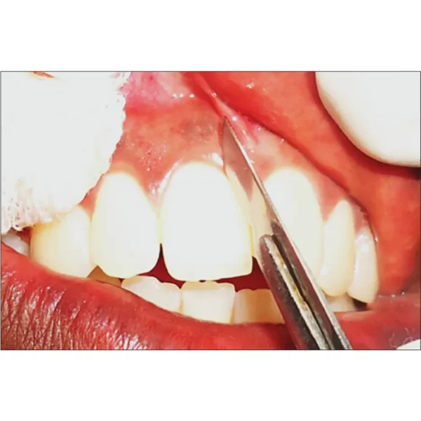 Gdc B.P.Handle 3no. - Image 2
