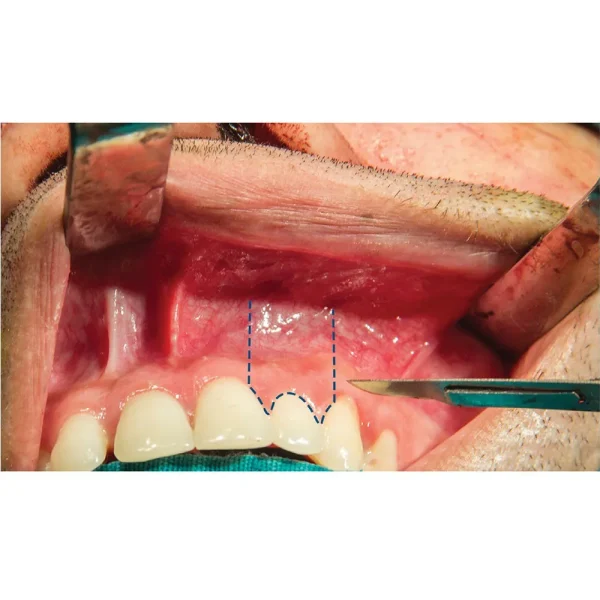 Gdc B.P.Handle 3no. - Image 3