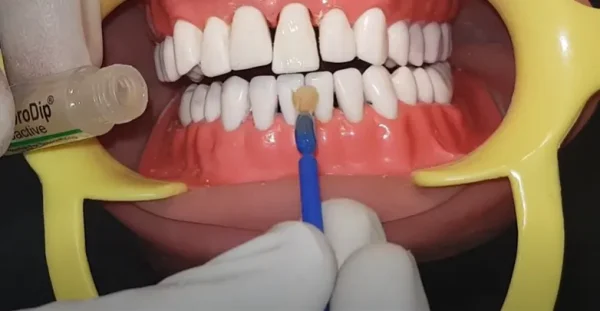 Prvest Fluorodip Bioactive - Image 3