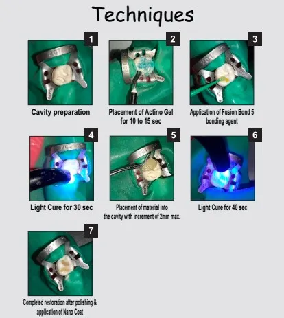 Fusion 7*4gm Kit - Image 4