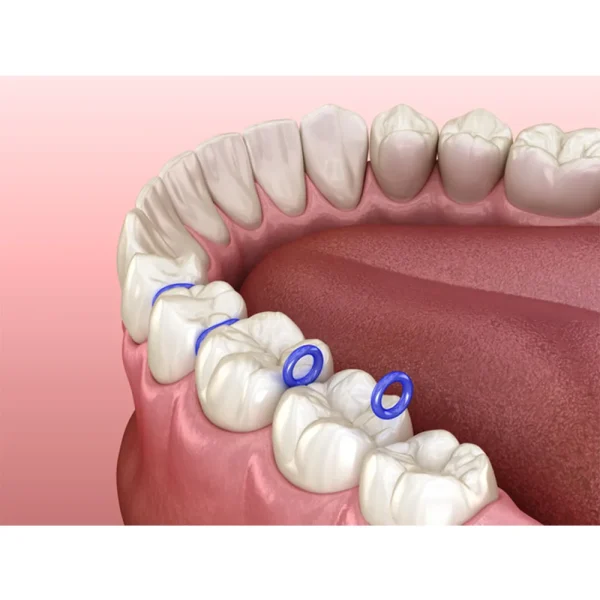 Ortho Elastic Blue - Image 3