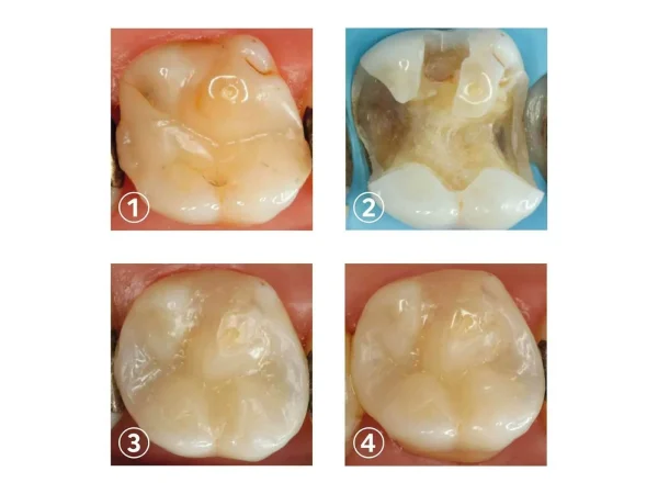 ReCreate Lc 2*2.5gm - Image 2