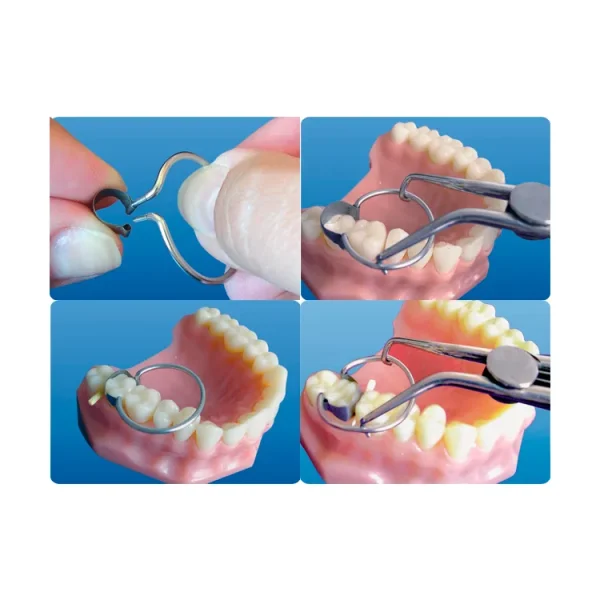 Saddle Matrix Kit - Image 2