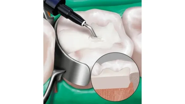 Mani Bulk Fill - Image 2